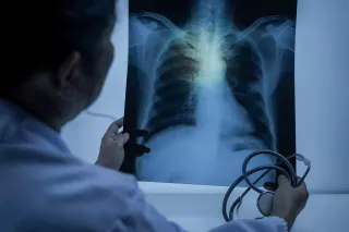 Obraz Rentgenodiagnostyka