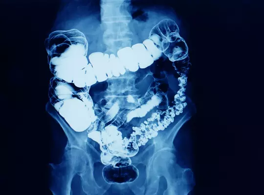 Jak przygotować się do badania: