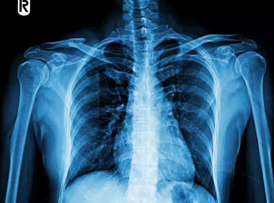 Jak przygotować się do badania: